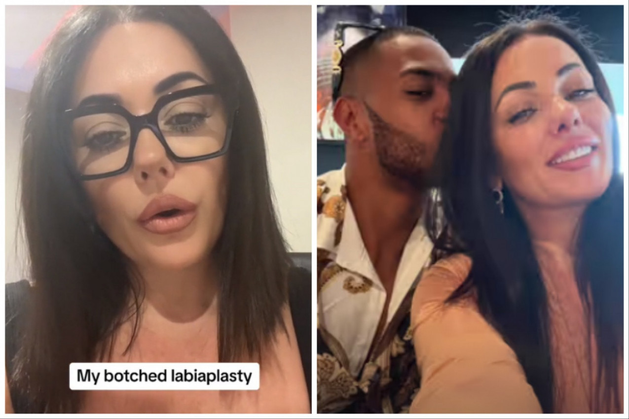 ZBOG UVREDA BIVŠEG NA RAČUN IZGLEDA NJENIH GENITALIJA URADILA JE LABIOPLASTIKU: "Sada se gorko kajem, ovu operaciju bi trebalo zabraniti!" (FOTO+VIDEO)