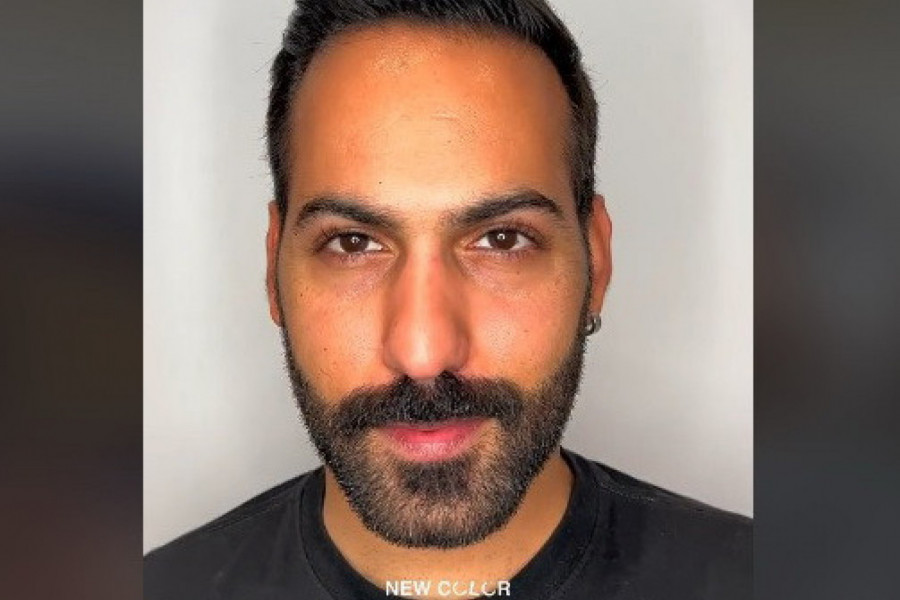 POGLEDAO SE U OGLEDALO I VRISNUO OD ŠOKA: Boja njegovih očiju potpuno se promenila a on je postao drugi čovek! (VIDEO)