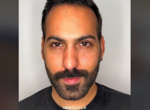 POGLEDAO SE U OGLEDALO I VRISNUO OD ŠOKA: Boja njegovih očiju potpuno se promenila a on je postao drugi čovek! (VIDEO)