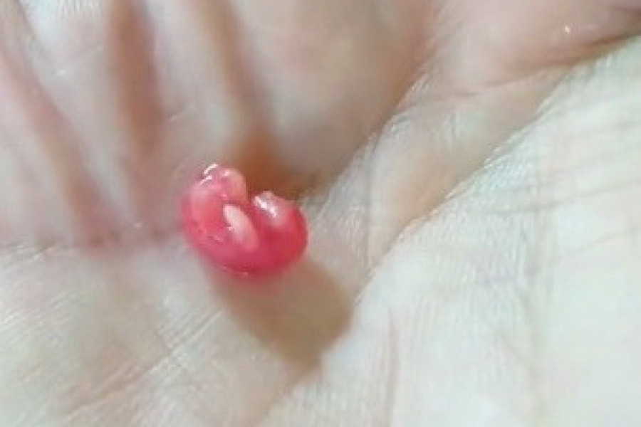 BRAČNI PAR JE PRONAŠAO NEOBIČNO STVORENJE U DVORIŠTU: Nisu ni sanjali da će iz njega izrasti ova životinja! (VIDEO)