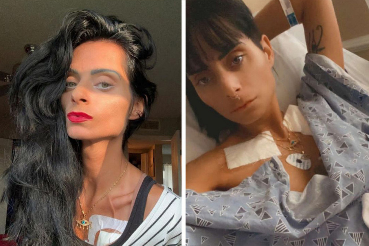 "RAZMIŠLJANJE O BUDUĆNOSTI JE ZASTRAŠUJUĆE, PRETVARAM SE U STATUU": Bolna ispovest devojke koja boluje od neizlečive bolesti kao Selin Dion