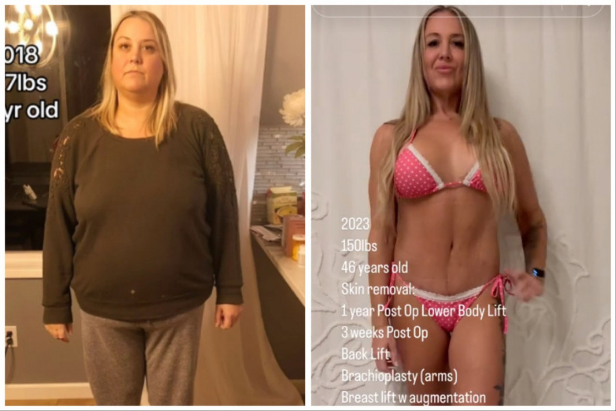 O TRANSFORMACIJI OVE ŽENE PRIČA CEO SVET: Ljudi u čudu, pitaju se kako je to uspela a ne znaju kakav je pakao prošla! (FOTO+VIDEO)