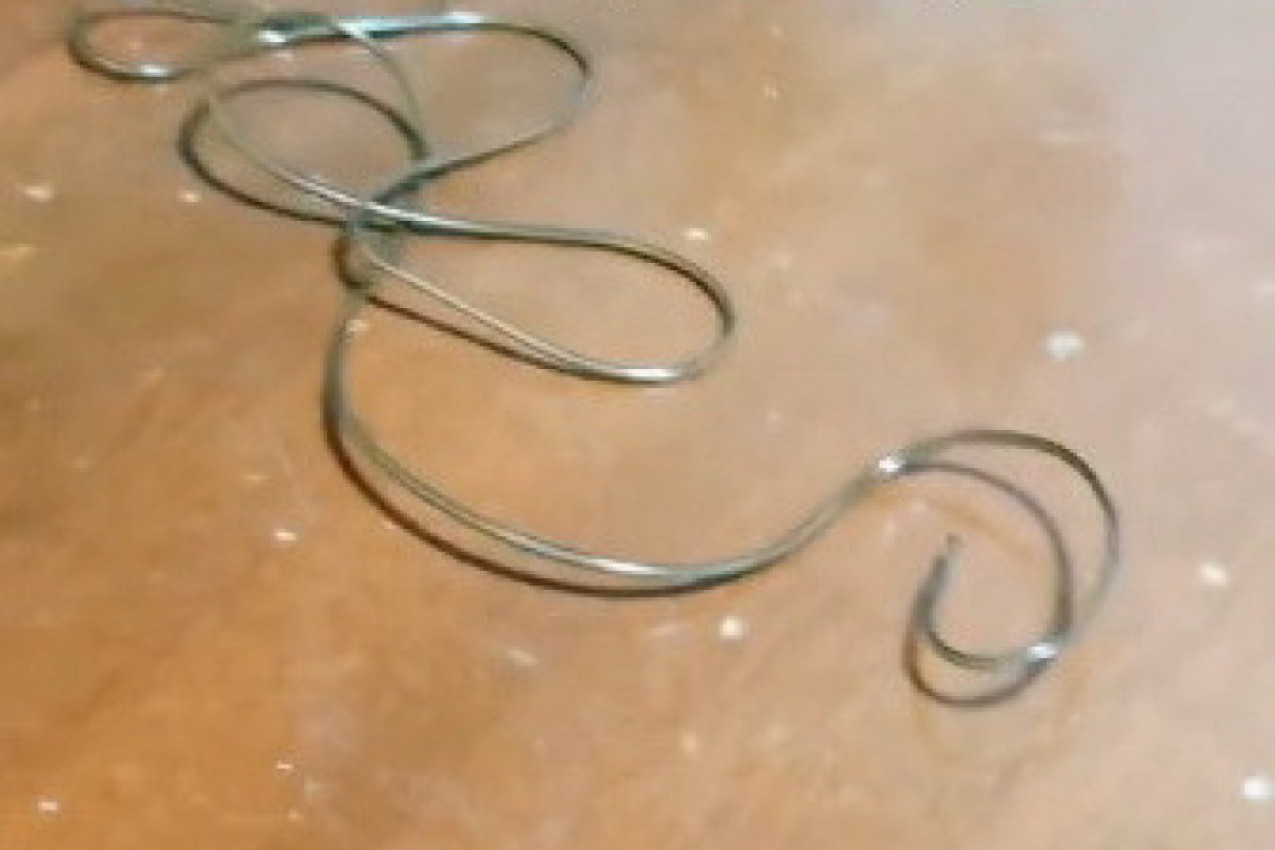 SVI SU MISLILI DA SE POMERA ŽICA NA PODU: Kada joj se približio, usledilo je šok saznanje!