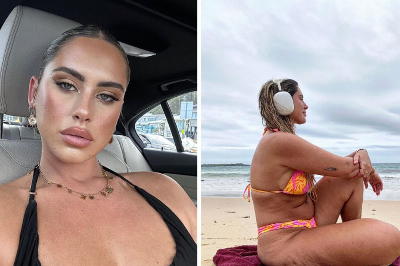 OVA LEPOTICA POKAZALA JE PRAVU SLIKU SVOG TELA: Bore i strije u krupnom kadru, a ovo su neverovatne reakcije javnosti!