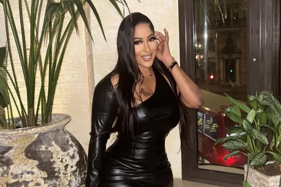 OTIŠLA JE U TURSKU DA OPERIŠE OBLINE: Kada se probudila nakon anestezije, zapanjila se onim što je videla, nije mogla da se smiri (VIDEO)