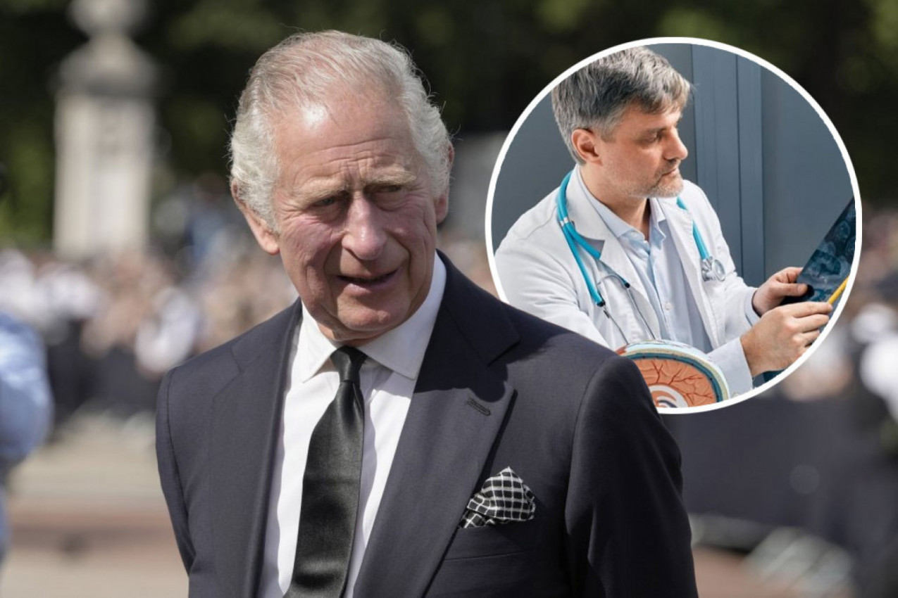 STRUČNJACI UPOZORAVAJU: Ovo je 6 najčešćih vrsta karcinoma od kojih oboljevaju stariji od 75 godina, među kojima je i kralj Čarls III
