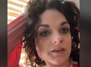 POJAVILA JOJ SE BOLNA KRASTA NA LICU: Kada je otišla kod lekara šokirala se dijagnozom koju je dobila, nije ni slutila šta će joj reći