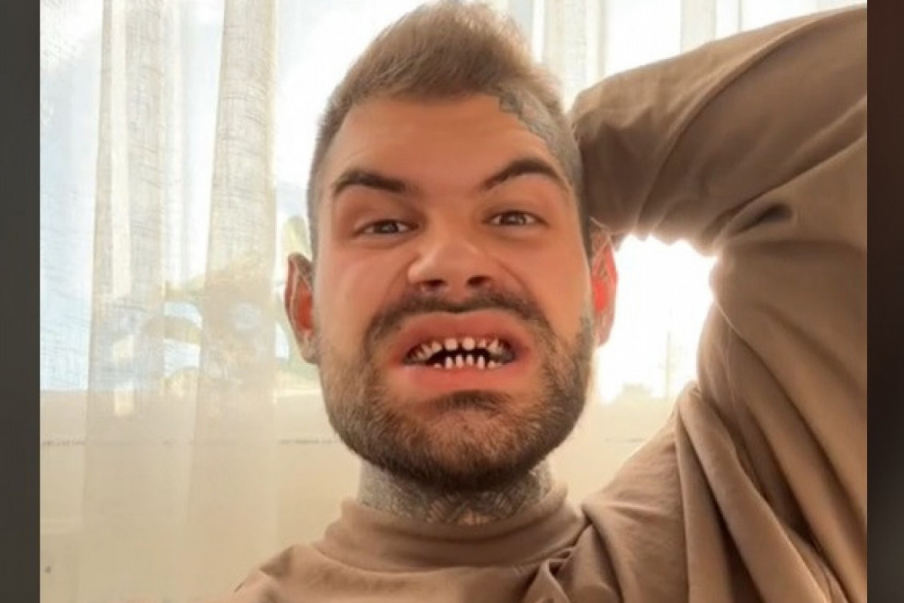 OTIŠAO JE U TURSKU PO BLISTAVO BELI OSMEH: Usledilo je nešto čemu se nije nadao, a ljudi na mrežama su mu poručili samo jedno! (VIDEO)