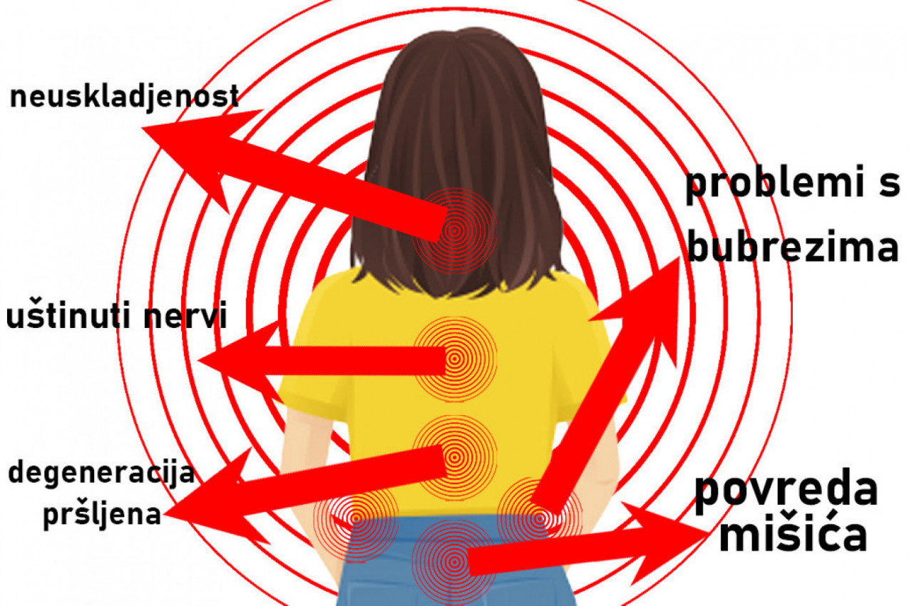 NIJE SVEJEDNO GDE VAS BOLE LEĐA: Često su pokazatelj podmuklih bolesti, a evo kad treba hitno da se javite lekaru! (FOTO)