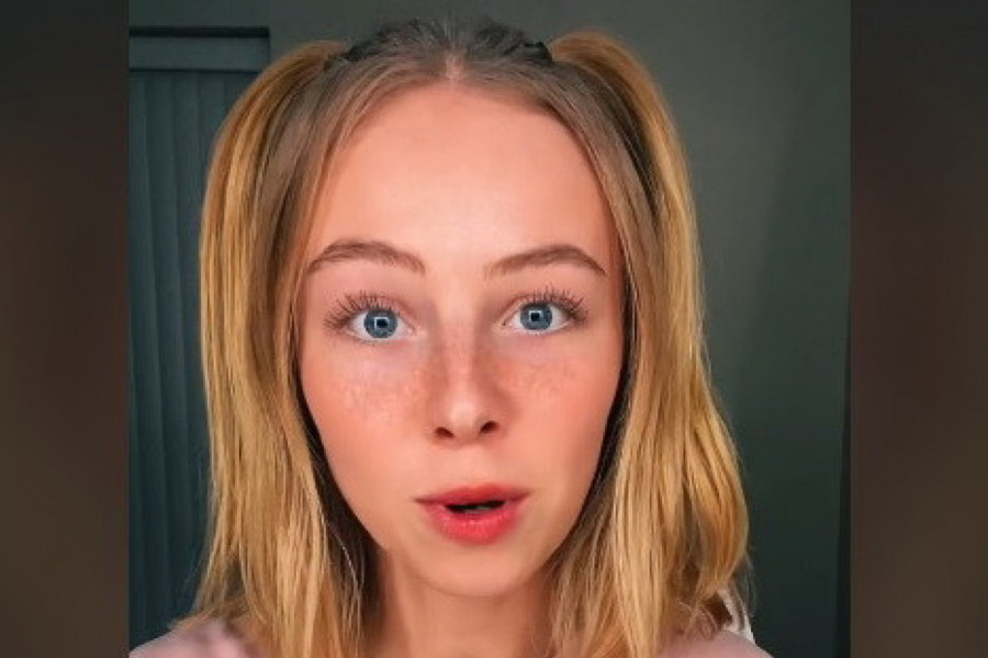 NIJE PRALA KOSU ŠAMPONOM 8 MESECI: Pogledajte kako sada izgleda! (FOTO)