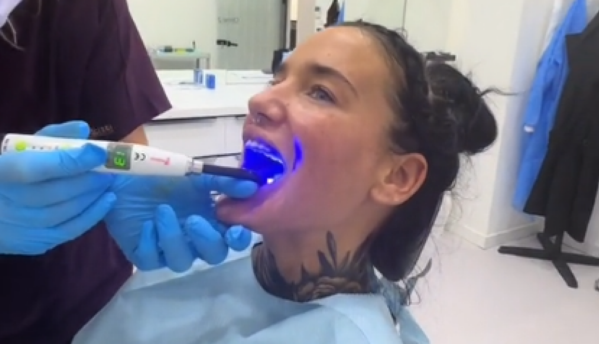 OTIŠLA JE U TURSKU DA URADI NOVE ZUBE: "Puno sreće uz doživotni bol i infekcije!" (FOTO+VIDEO)