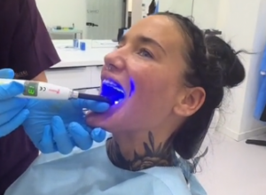 OTIŠLA JE U TURSKU DA URADI NOVE ZUBE: "Puno sreće uz doživotni bol i infekcije!" (FOTO+VIDEO)