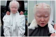 TRANSFORMACIJA ALBINO DEVOJKE O KOJOJ BRUJI INTERNET: Devojka je u neverici gledala svoj odraz u ogledalu sa očima punim suza! (FOTO+VIDEO)