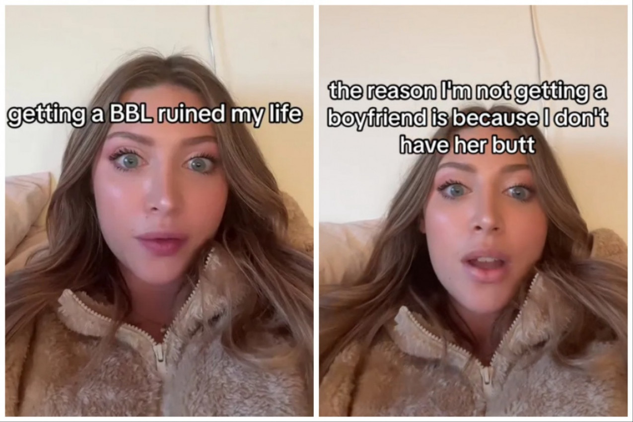 HTELA JE OBLINE POPUT KIM KARDAŠIJAN, PA JE PLATILA PODIZANJE ZADNJICE 12.000 EVRA: "Ličila sam na kravu i svi su me gledali kao objekat!"