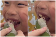 OVAKVU METODU VAĐENJA ZUBA DECI NIKAD NISTE VIDELI: Snimak samo za one sa jakim želucem! (FOTO+VIDEO)