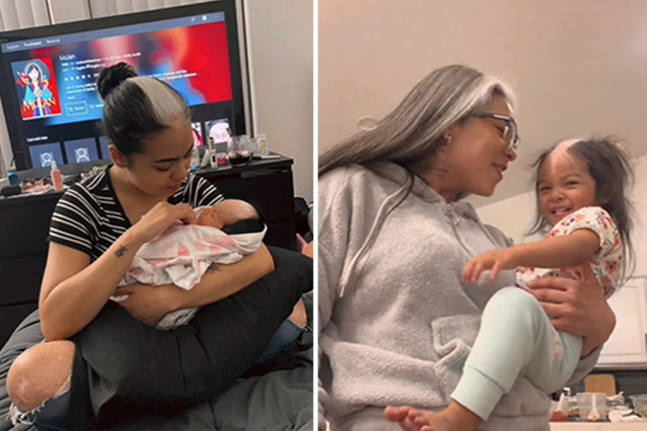 LJUDI ŠOKIRANI ZBOG BEBINE SEDE KOSE: Majka i ćerka kao preslikane, a obe su rođene "sa greškom" zbog koje izgledaju preslatko!