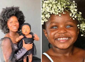 SVET JE BIO OPSEDNUT OČIMA OVE BEBE: Zapanjićete se kad vidite kako sada izgleda (VIDEO)