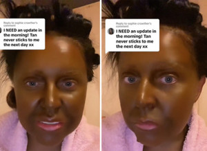 HTELA JE DA IZGLEDA PREPLANULO, A NA KRAJU JOJ KOŽA POZELENELA: Ova greška sa kremom za samopotamnjivanje skupo ju je koštala!