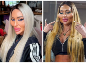 ANASTASIJA JE "HODAJUĆA PLASTIKA": Evo kako je izgledala pre operacija, ljudi se pitaju - što je to sebi uradila?