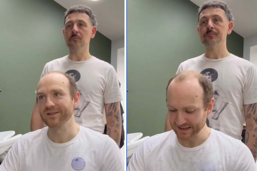 ŠOK TRANFORMACIJA GLUMCA: Ćelavost mu je uništavala život, radikalan potez je usledio nakon gubitka posla! (VIDEO)