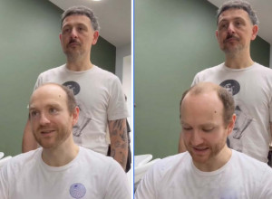 ŠOK TRANFORMACIJA GLUMCA: Ćelavost mu je uništavala život, radikalan potez je usledio nakon gubitka posla! (VIDEO)