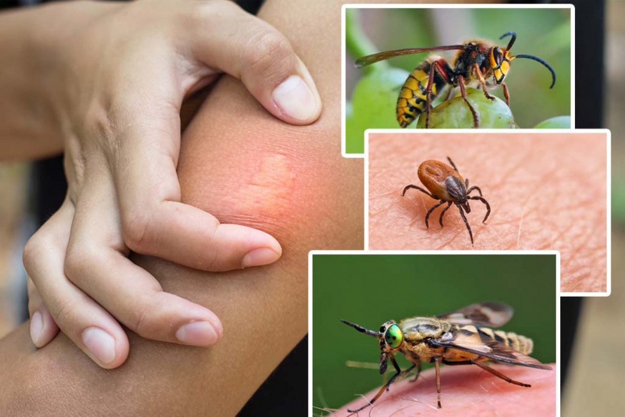ŠTA DA RADITE KAD VAS UJEDU OSA, KRPELJ ILI OBAD? Kako da znate koja vas je buba ujela i kada da tražite pomoć lekara
