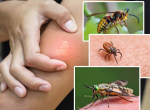 ŠTA DA RADITE KAD VAS UJEDU OSA, KRPELJ ILI OBAD? Kako da znate koja vas je buba ujela i kada da tražite pomoć lekara