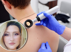 DIJANOSTIKOVALA SAM MELANOM KOD OSOBE OD 27 GODINA: Dr Popović izdala upozorenje za sve - jedno ne smete da preskočite!