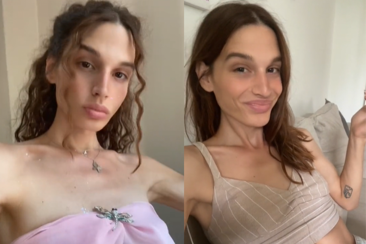 "ŠTO SI MENJALA POL AKO TI SE SVIĐAJU ŽENE?" Hana pokazala kako je izgledala pre svih operacija - neviđeno (VIDEO)