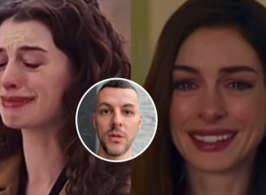 UPLAKANO LICE GLUMICE BEZ I SA BOTOKSOM - DVE RAZLIČITE OSOBE: Izgleda mlađe nego sa 20, evo mišljenja dr Stojićevića