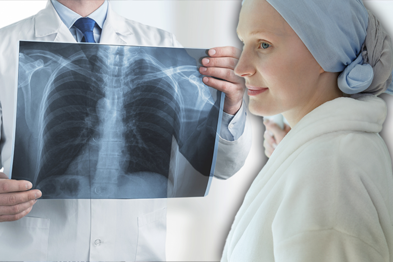 OVIH 6 LOŠIH NAVIKA IZAZIVA POLOVINU SLUČAJEVA RAKA: Proverite da li ste u rizičnoj grupi i gde grešite!