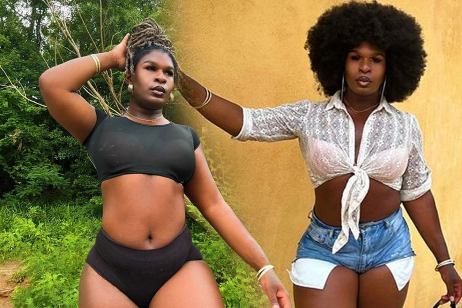 IMA ZNAKE I MUŠKOG I ŽENSKOG POLA: Rođena kao hermafrodit - ŠOK priča dobila zaokret, ostala je trudna i desilo se ovo