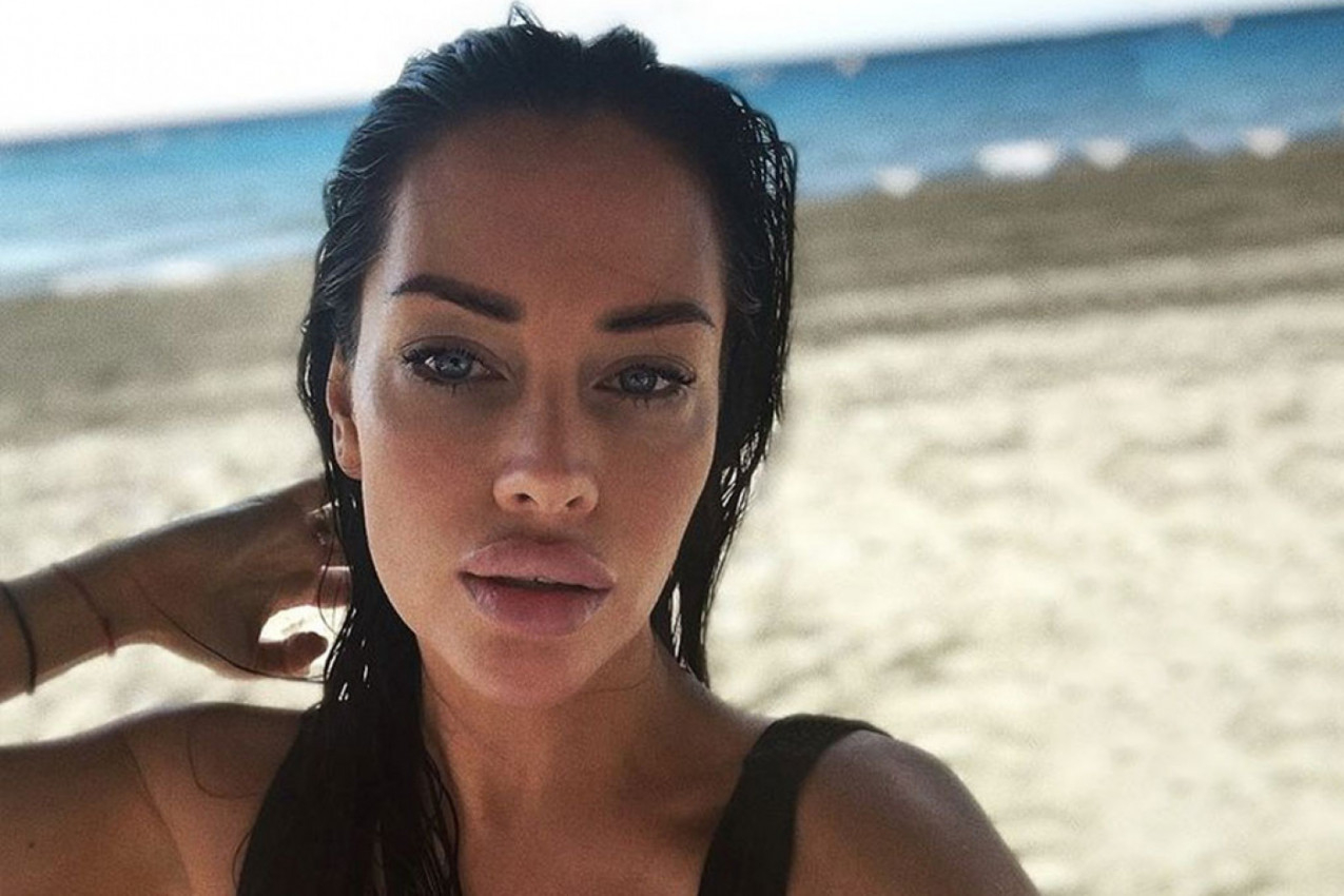 ŽENA OGNJENA AMIDŽIĆA IMA NIKAD MANJI STRUK: Vrela fotka nakon porođaja pokazuje koliko je VAU, Mina gori (FOTO)