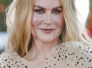 OD LICA SLAVNE GLUMICE U VENECIJI PODILAZI JEZA: Doktorka pobrojala šta je radila - to ne može bez operacije!