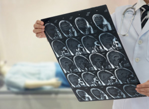 OVO SVI SRBI RADE, A KARDIOLOZI TVRDE DA OVA JUTARNJA NAVIKA MOŽE DA POVEĆA RIZIK OD TROMBA! Najvažnije je da uradite OVO čim se probudite