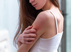 MUČI VAS HRONIČAN SVRAB KOŽE KOJI SE ŠIRI PO TELU, TO MOŽE DA BUDE PRVI SIMPTOM OPASNE BOLESTI: Ukoliko ovo primetite, odmah se javite lekaru