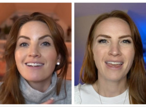 DOKTORKA POBEDILA RAK I SAD OTKRIVA: "Obavezno jedite ove 2 namirnice" - bez jedne Srbi ne mogu! (VIDEO)