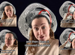 DOKTORI MI NISU VEROVALI, VRATILI SU ME KUĆI I REKLI DA JE SAMO UGANUĆE: Šokirala sam se kad su otkrili šta mi je raslo u nozi, 3 simptoma su me razarala!