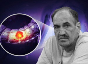 PRVI SIMPTOM BOLESTI OD KOJE JE PREMINUO DRAŽEN DALIPAGIĆ JE PODMUKAO! Čuveni onkolog otkrio na šta PRVO treba obratiti pažnju i ko je u najvećem riziku!