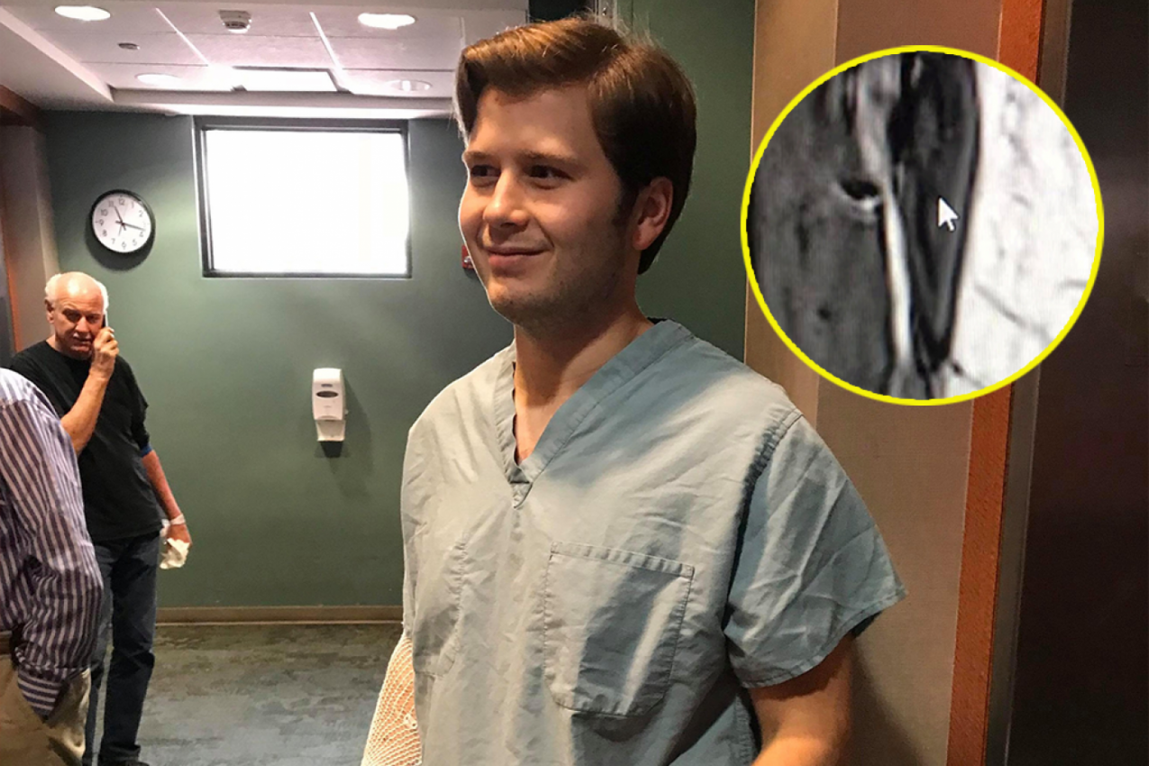 MLADI STUDENT JE OSETIO BOL U KOLENU, ALI JE POMISLIO DA JE SAMO URASLA DLAKA! Kopao je po tome i usledio je ŠOK!