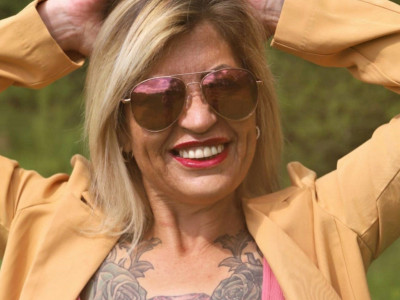 Pre intervencije u Turskoj Viki je imala krunice, ali nije bila zadovoljna njima 