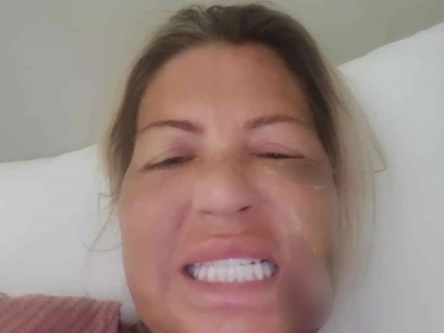 Njene krunice samo spolja izgledaju lepo i čisto, s unutrašnje strane su popucale   