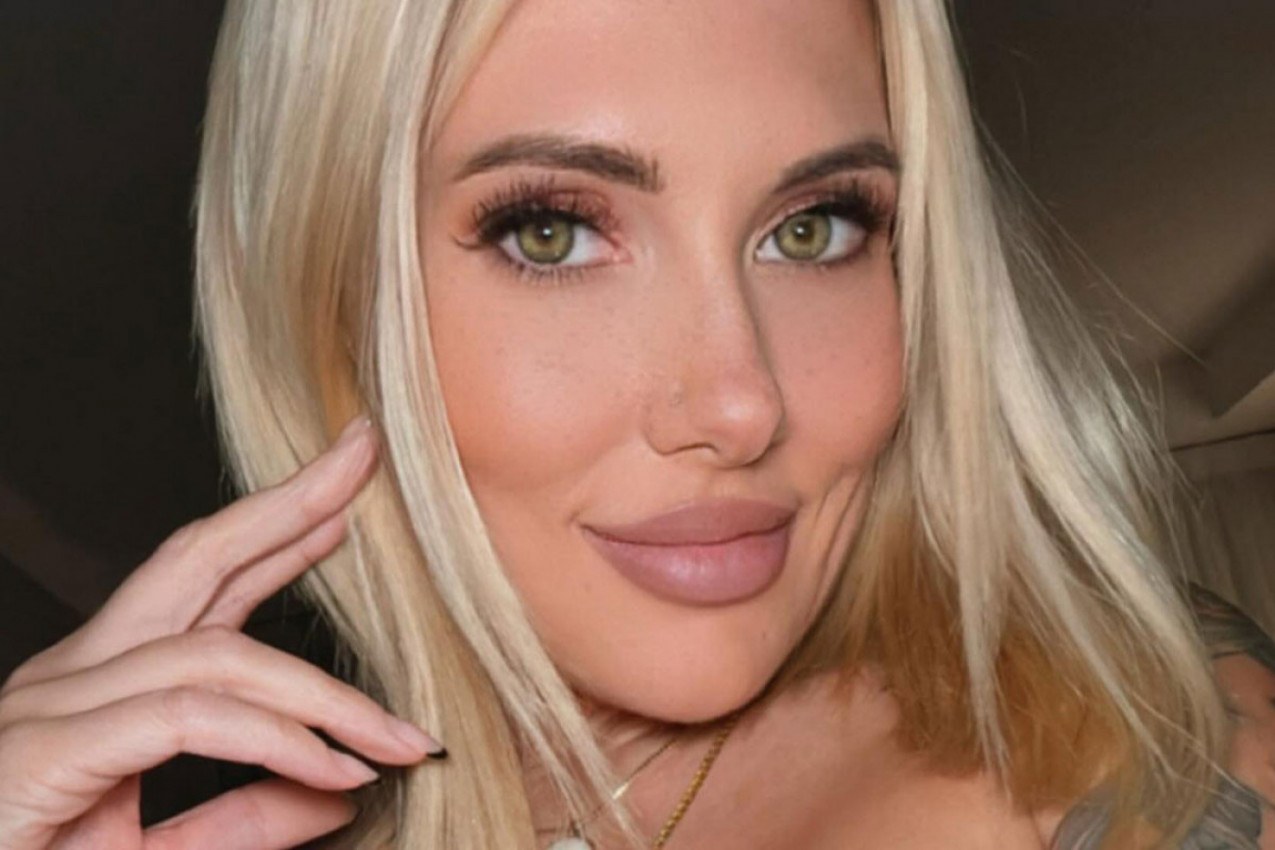 UDARIO JU JE GROM NA BOŽIĆ, BILA JE PARALIZOVANA 9 SATI, A ONDA SE POGLEDALA U OGLEDALO I ZANEMELA: Jedan deo tela sada joj je potpuno drugačiji!