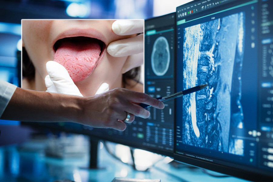 OVA PROMENA NA JEZIKU POKAZALA JE DA SE BORI SA RAKOM - sada i vas upozorava! To uživanje je najveći faktor rizika, a Srbi ga se teško odriču