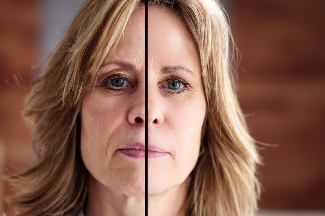 U 67. GODINI JE PLATILA 137.000 EVRA DA BI IZGLEDALA KAO DEVOJKA: Njena transformacija ostavila je u šoku čak i lekare (FOTO)