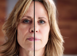 U 67. GODINI JE PLATILA 137.000 EVRA DA BI IZGLEDALA KAO DEVOJKA: Njena transformacija ostavila je u šoku čak i lekare (FOTO)