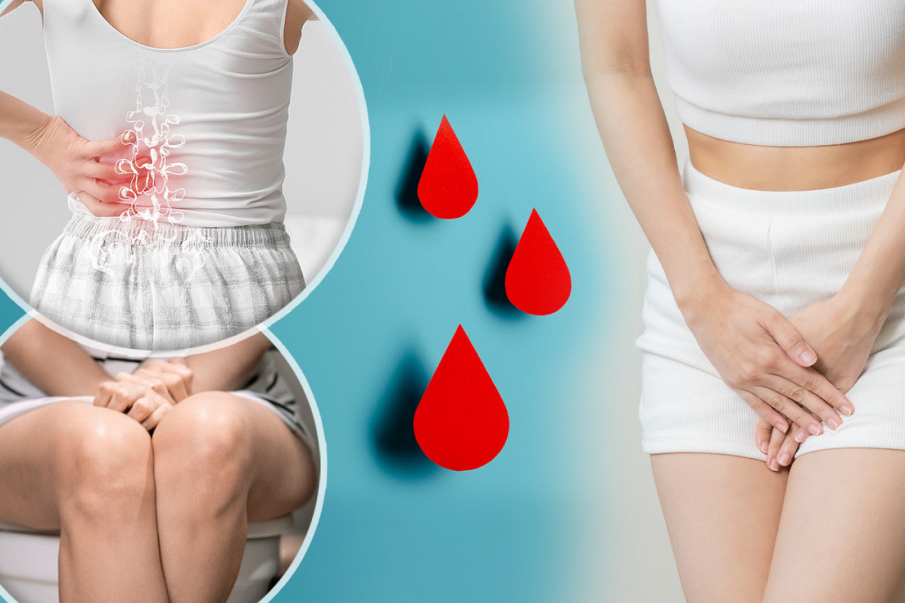 RANI ZNACI UPOZORENJA NA OBIČNU INFEKCIJU KOJA MOŽE POSTATI FATALNA AKO SE NE LEČI: Prvi simptom vidi se i u mokraći!