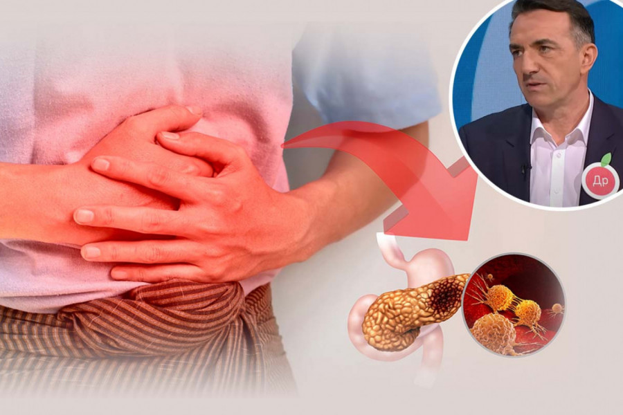 KLJUČNI SIMPTOM RAKA PANKREASA JAVLJA SE NA JEDNOM NEOBIČNOM MESTU! Zabrinjavajuće upozorenje čuvenog hirurga Protića: Ova bolest je uzela maha u Srbiji, kosi sve pred sobom