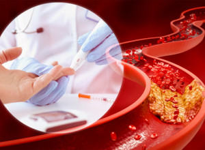 I MRŠAVI LJUDI IMAJU POVIŠEN LOŠ HOLESTEROL: Čuveni kardiolog prof. dr Otašević UPOZORAVA koja kategorija LJUDI je posebno ugrožena!