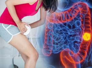 OVA PROMENA U STOLICI MOŽE DA BUDE PRVI ZNAK RAKA DEBELOG CREVA: Nije samo krv zabrinjavajuća, i ovo je ALARM